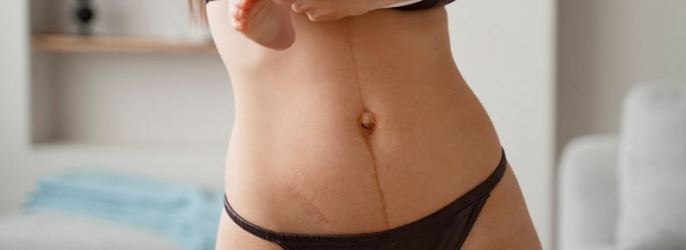 Masaje Postquirúrgico